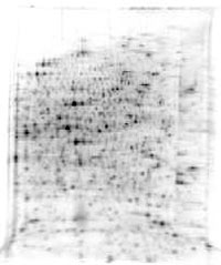 Electrophoresis image with 1900+ proteins represented as dark spots on the bright background.