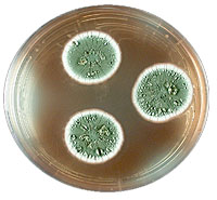 Figure showing an inoculation of the fungal culture.