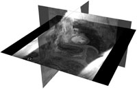 Cardiac MRI volume visualized using three orthogonal cutting planes (secondary planes are semi-transparent).