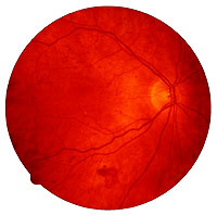 Retinal fundus image.