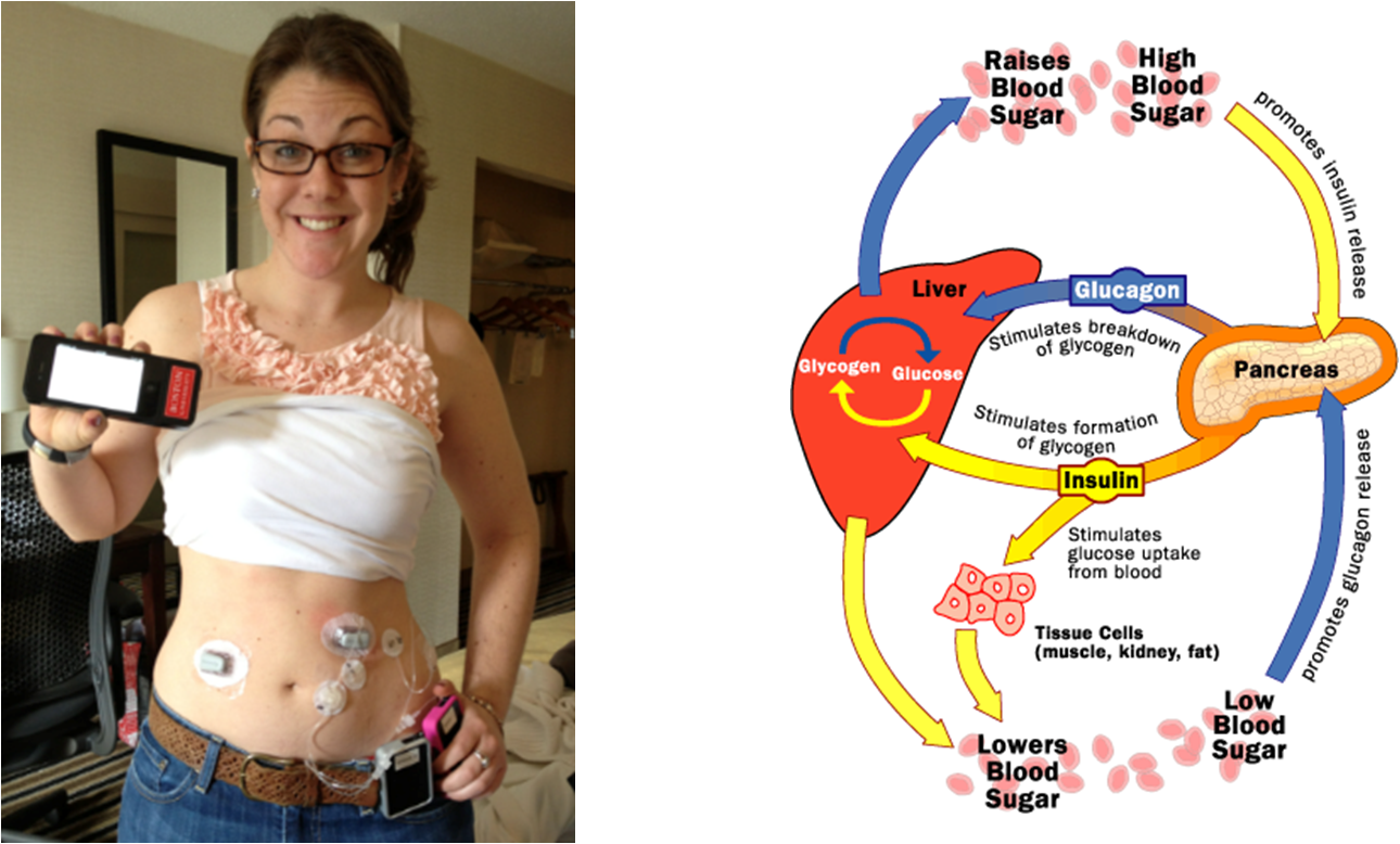 Insulin Glucagon AP